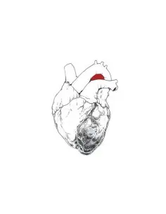 Swans - The Beggar